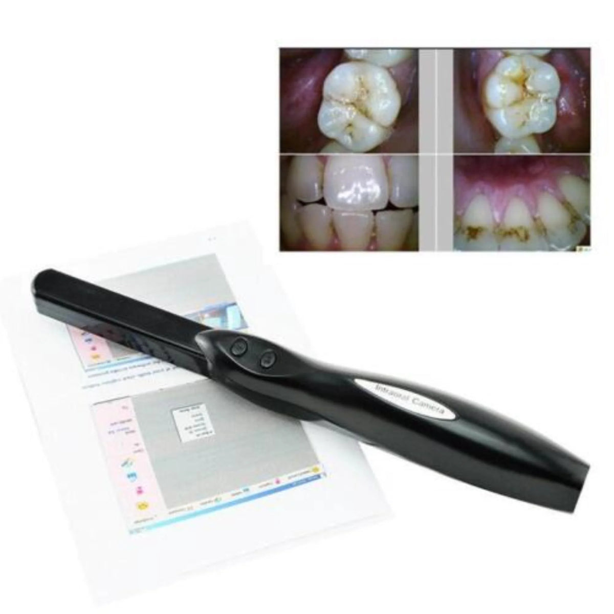 6MP 6-LEDs USB 2.0 Dental Intraoral Camera U84839
